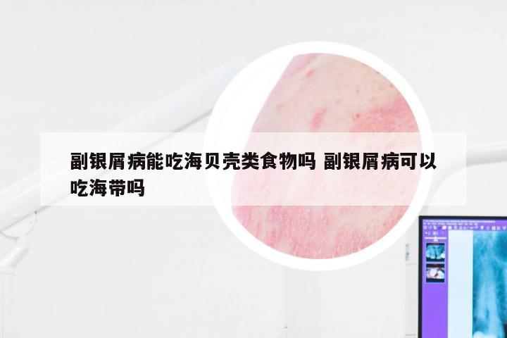 副银屑病能吃海贝壳类食物吗 副银屑病可以吃海带吗