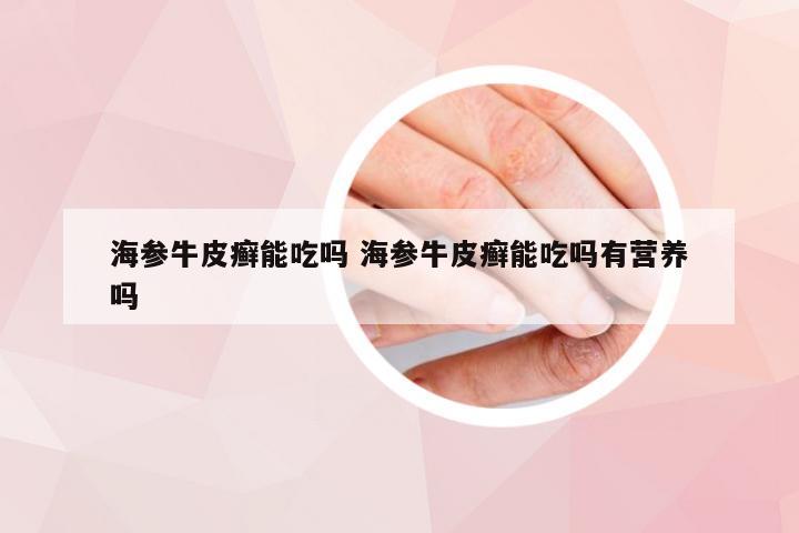 海参牛皮癣能吃吗 海参牛皮癣能吃吗有营养吗