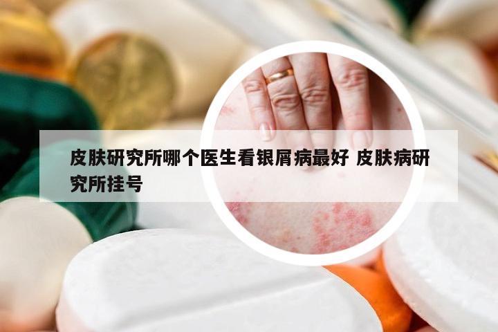 皮肤研究所哪个医生看银屑病最好 皮肤病研究所挂号