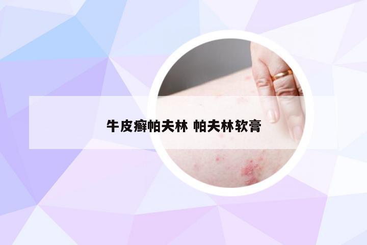 牛皮癣帕夫林 帕夫林软膏