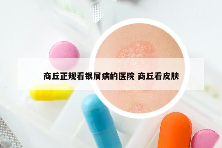 商丘正规看银屑病的医院 商丘看皮肤