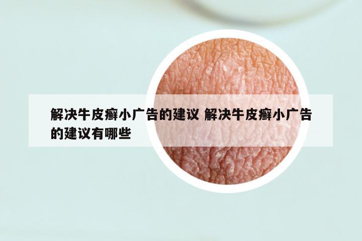 解决牛皮癣小广告的建议 解决牛皮癣小广告的建议有哪些