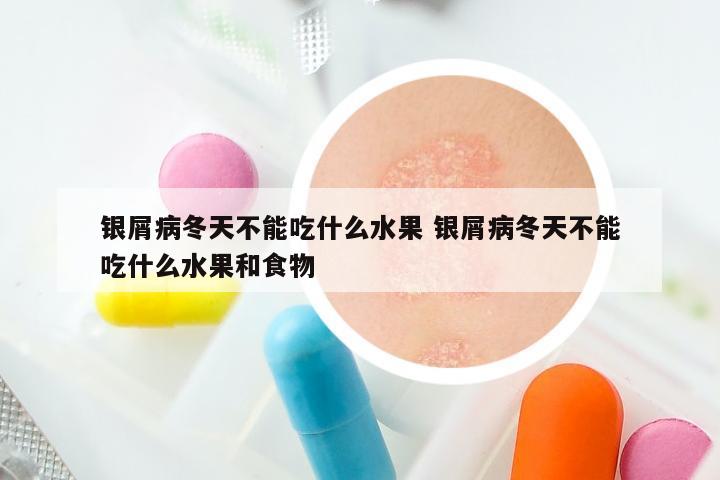 银屑病冬天不能吃什么水果 银屑病冬天不能吃什么水果和食物