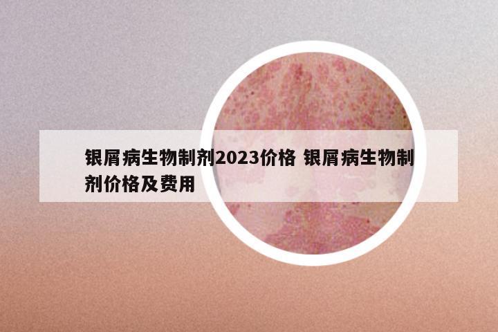 银屑病生物制剂2023价格 银屑病生物制剂价格及费用