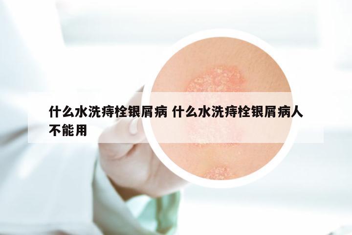 什么水洗痔栓银屑病 什么水洗痔栓银屑病人不能用