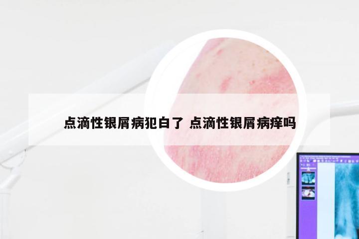 点滴性银屑病犯白了 点滴性银屑病痒吗
