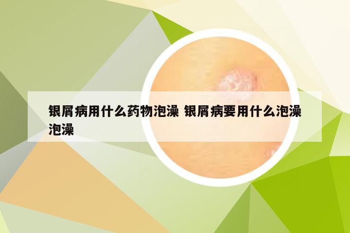 银屑病用什么药物泡澡 银屑病要用什么泡澡泡澡