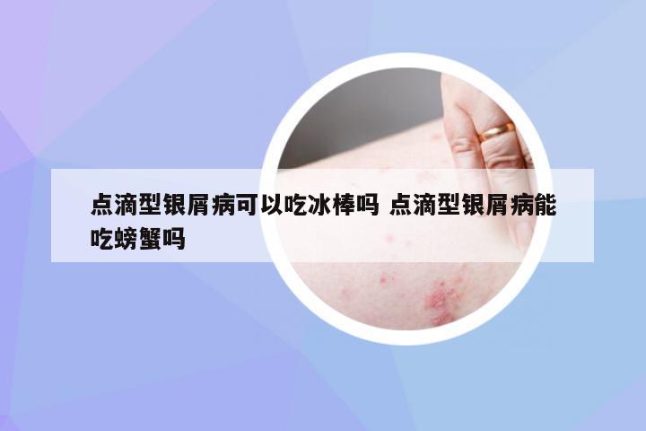 点滴型银屑病可以吃冰棒吗 点滴型银屑病能吃螃蟹吗