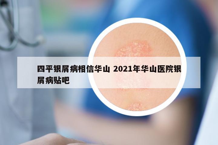 四平银屑病相信华山 2021年华山医院银屑病贴吧