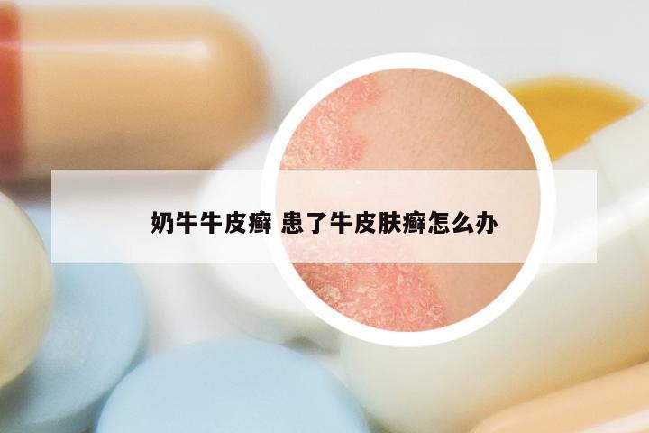 奶牛牛皮癣 患了牛皮肤癣怎么办