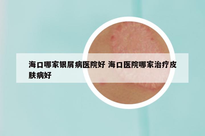 海口哪家银屑病医院好 海口医院哪家治疗皮肤病好