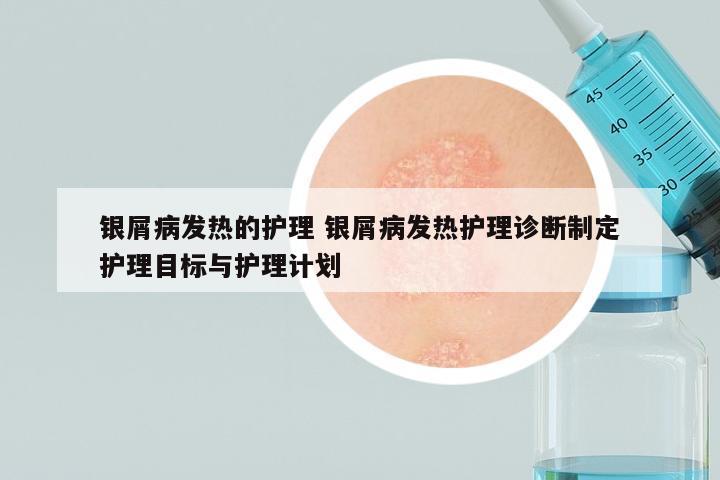 银屑病发热的护理 银屑病发热护理诊断制定护理目标与护理计划