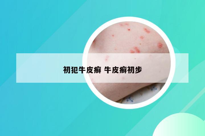 初犯牛皮癣 牛皮癣初步