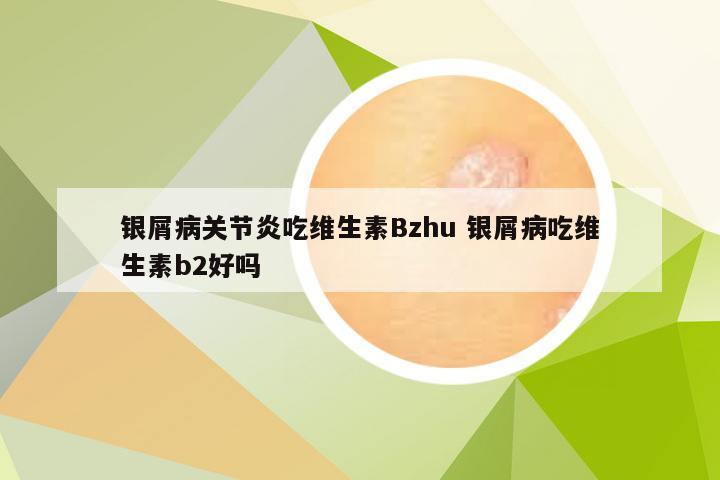 银屑病关节炎吃维生素Bzhu 银屑病吃维生素b2好吗