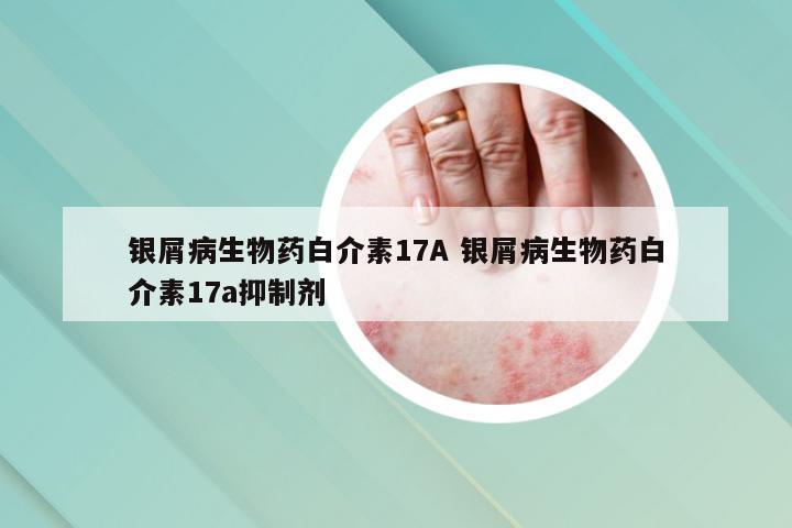 银屑病生物药白介素17A 银屑病生物药白介素17a抑制剂