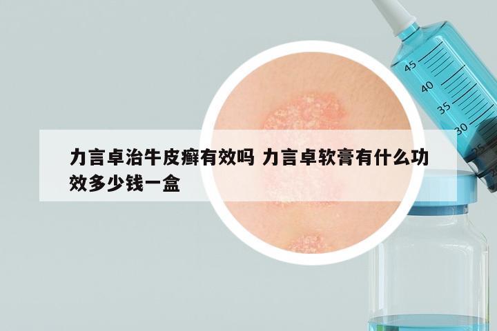 力言卓治牛皮癣有效吗 力言卓软膏有什么功效多少钱一盒