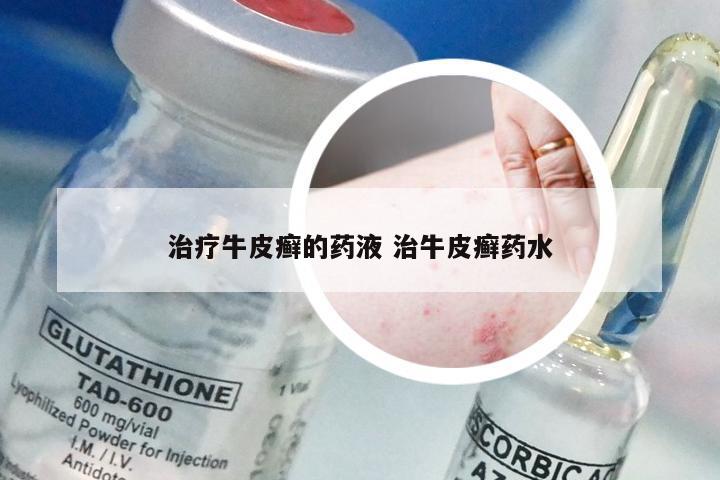 治疗牛皮癣的药液 治牛皮癣药水