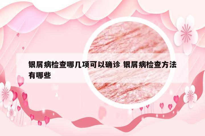 银屑病检查哪几项可以确诊 银屑病检查方法有哪些