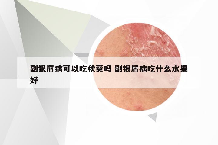 副银屑病可以吃秋葵吗 副银屑病吃什么水果好