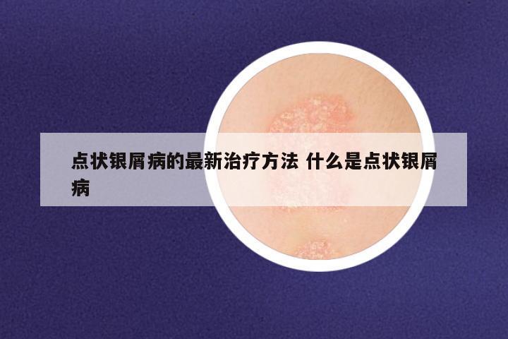 点状银屑病的最新治疗方法 什么是点状银屑病