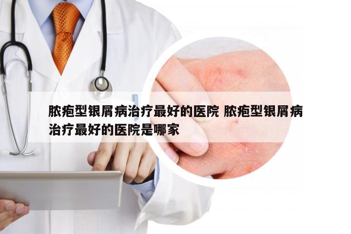 脓疱型银屑病治疗最好的医院 脓疱型银屑病治疗最好的医院是哪家