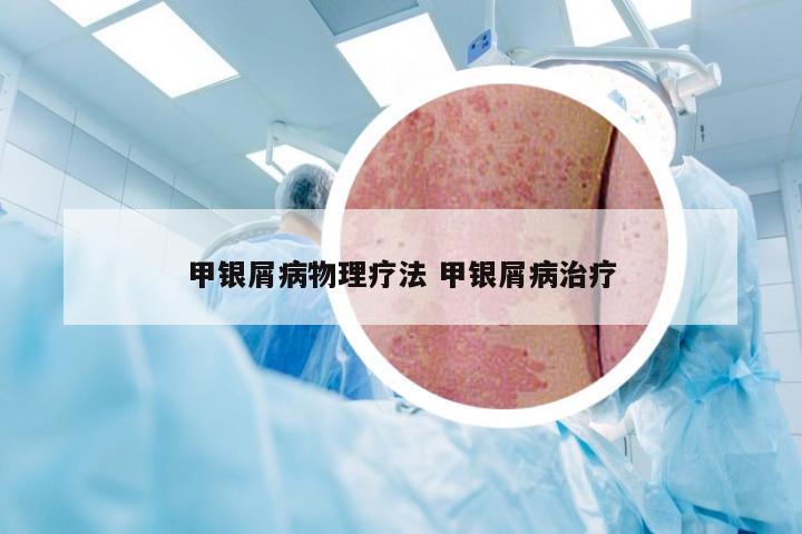 甲银屑病物理疗法 甲银屑病治疗