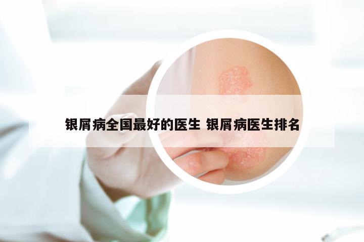 银屑病全国最好的医生 银屑病医生排名