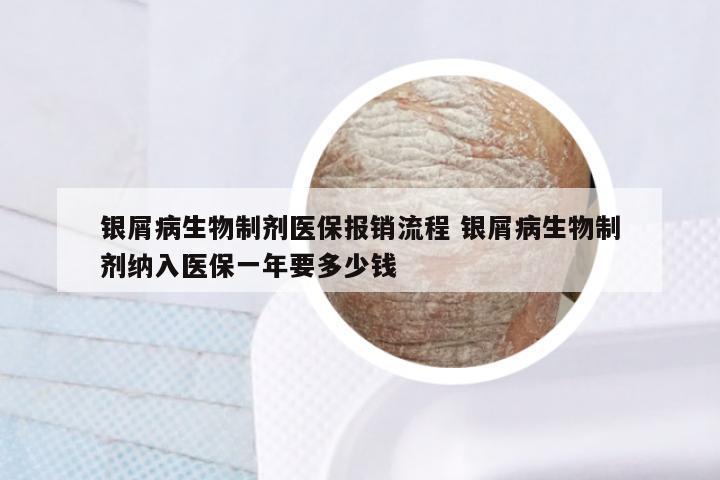 银屑病生物制剂医保报销流程 银屑病生物制剂纳入医保一年要多少钱