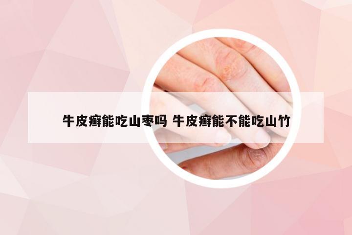 牛皮癣能吃山枣吗 牛皮癣能不能吃山竹