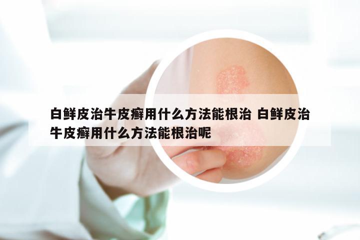 白鲜皮治牛皮癣用什么方法能根治 白鲜皮治牛皮癣用什么方法能根治呢