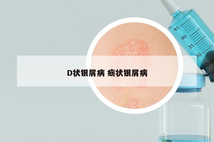 D状银屑病 癍状银屑病