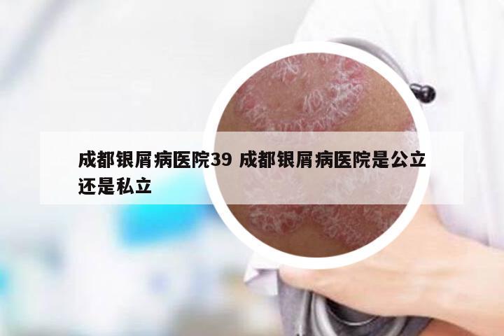 成都银屑病医院39 成都银屑病医院是公立还是私立