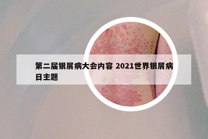 第二届银屑病大会内容 2021世界银屑病日主题