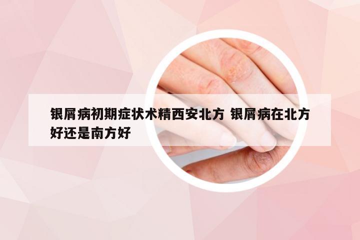 银屑病初期症状术精西安北方 银屑病在北方好还是南方好