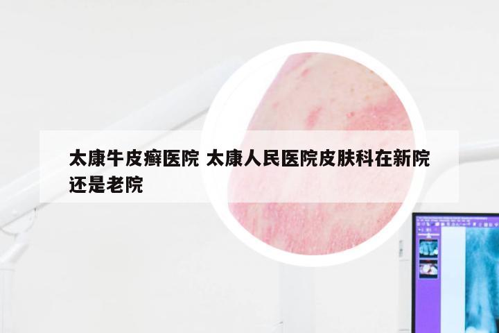 太康牛皮癣医院 太康人民医院皮肤科在新院还是老院