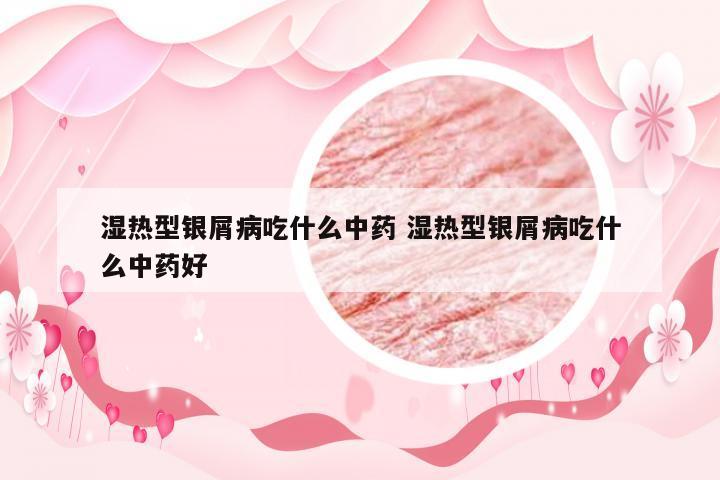 湿热型银屑病吃什么中药 湿热型银屑病吃什么中药好