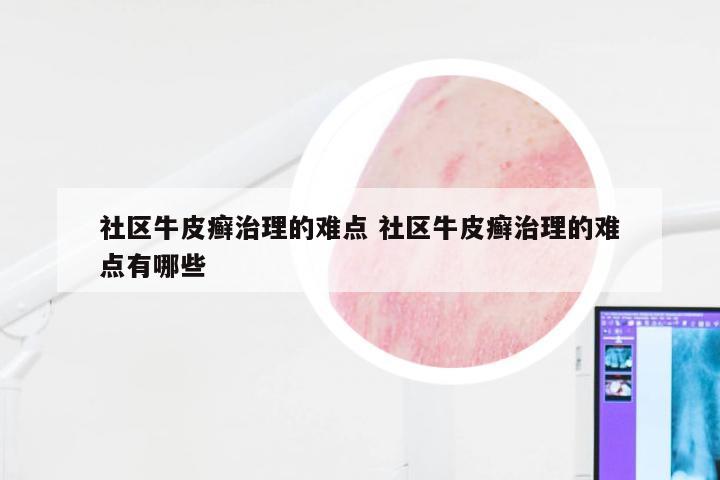 社区牛皮癣治理的难点 社区牛皮癣治理的难点有哪些