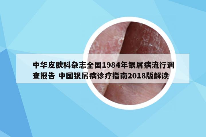 中华皮肤科杂志全国1984年银屑病流行调查报告 中国银屑病诊疗指南2018版解读