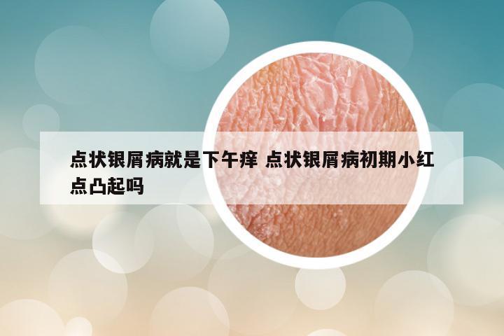 点状银屑病就是下午痒 点状银屑病初期小红点凸起吗