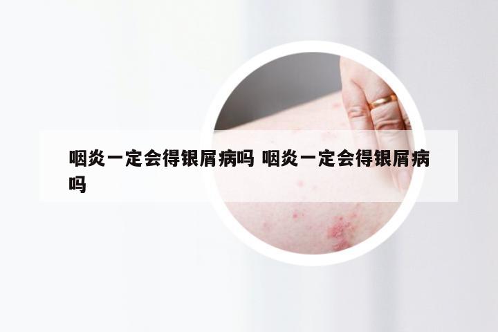 咽炎一定会得银屑病吗 咽炎一定会得银屑病吗