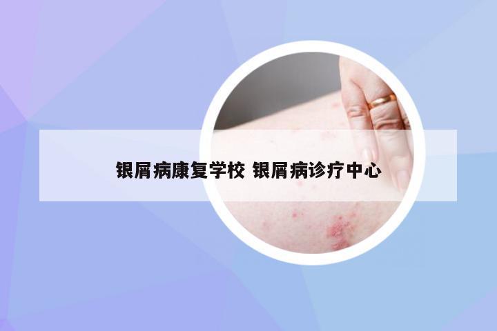 银屑病康复学校 银屑病诊疗中心