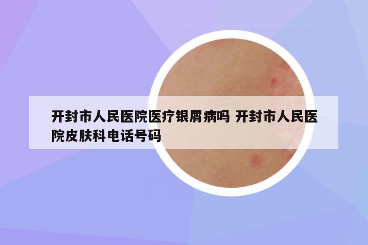 开封市人民医院医疗银屑病吗 开封市人民医院皮肤科电话号码