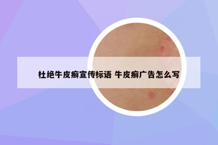 杜绝牛皮癣宣传标语 牛皮癣广告怎么写
