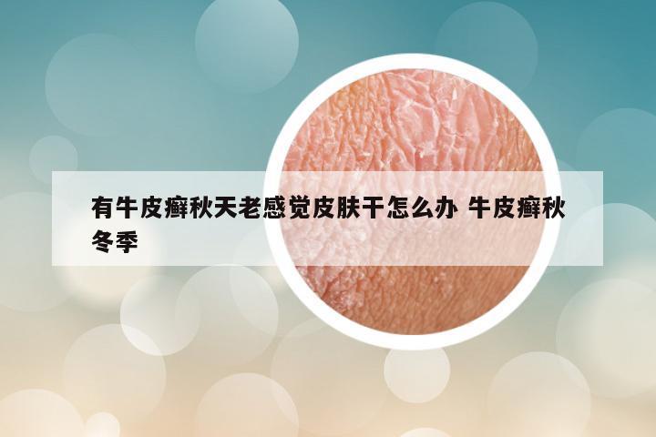 有牛皮癣秋天老感觉皮肤干怎么办 牛皮癣秋冬季