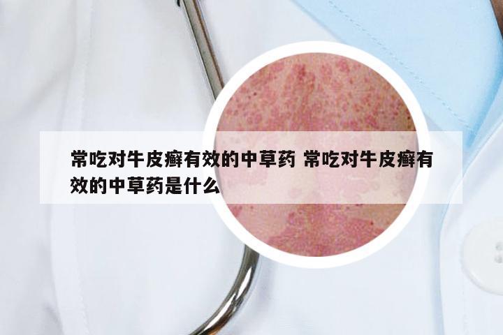 常吃对牛皮癣有效的中草药 常吃对牛皮癣有效的中草药是什么