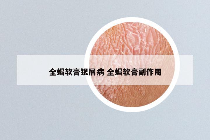 全蝎软膏银屑病 全蝎软膏副作用