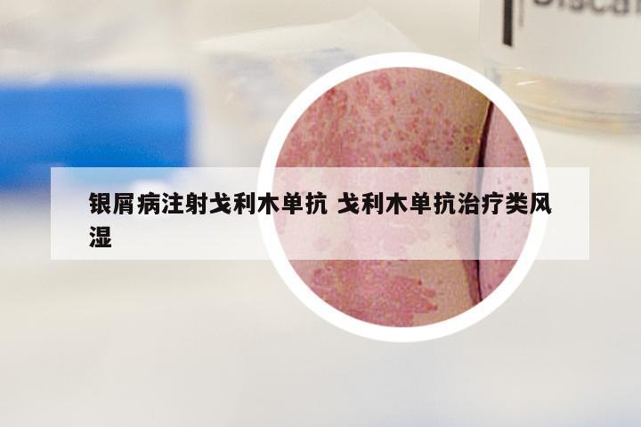银屑病注射戈利木单抗 戈利木单抗治疗类风湿