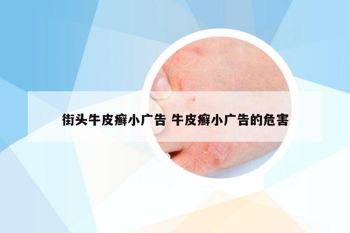 街头牛皮癣小广告 牛皮癣小广告的危害
