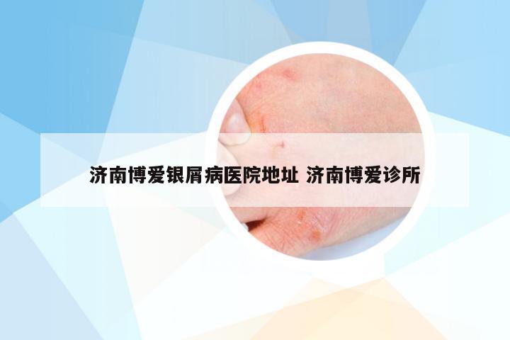 济南博爱银屑病医院地址 济南博爱诊所