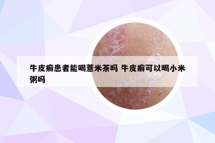 牛皮癣患者能喝薏米茶吗 牛皮癣可以喝小米粥吗